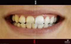 dientes.jpg
