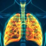 Aerosol de vaporizador y expresión génica en tejido pulmonar humano en comparación con el humo de cigarrillos